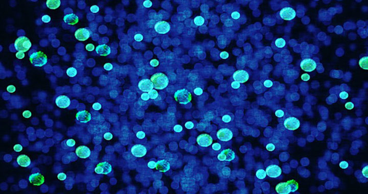 The Difference Between Bacteria and Archaea